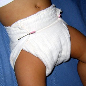 Pinned-Prefold